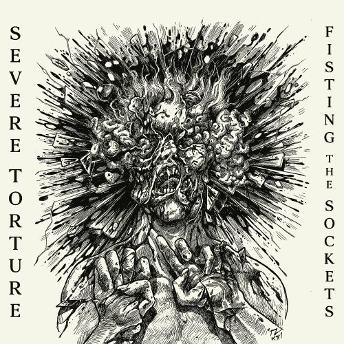 severe torture – fisting the sockets [ep]